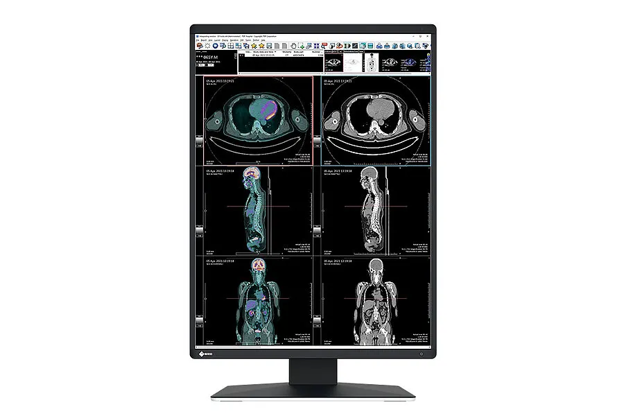[11000088] EIZO Befundmonitor RX370 RadiForce
